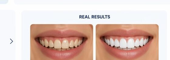 Before and after dental treatment results at Huntington Park Dental Clinic