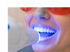 Professional Teeth Whitening in Huntington Park, CA at Huntington Park Dental Clinic